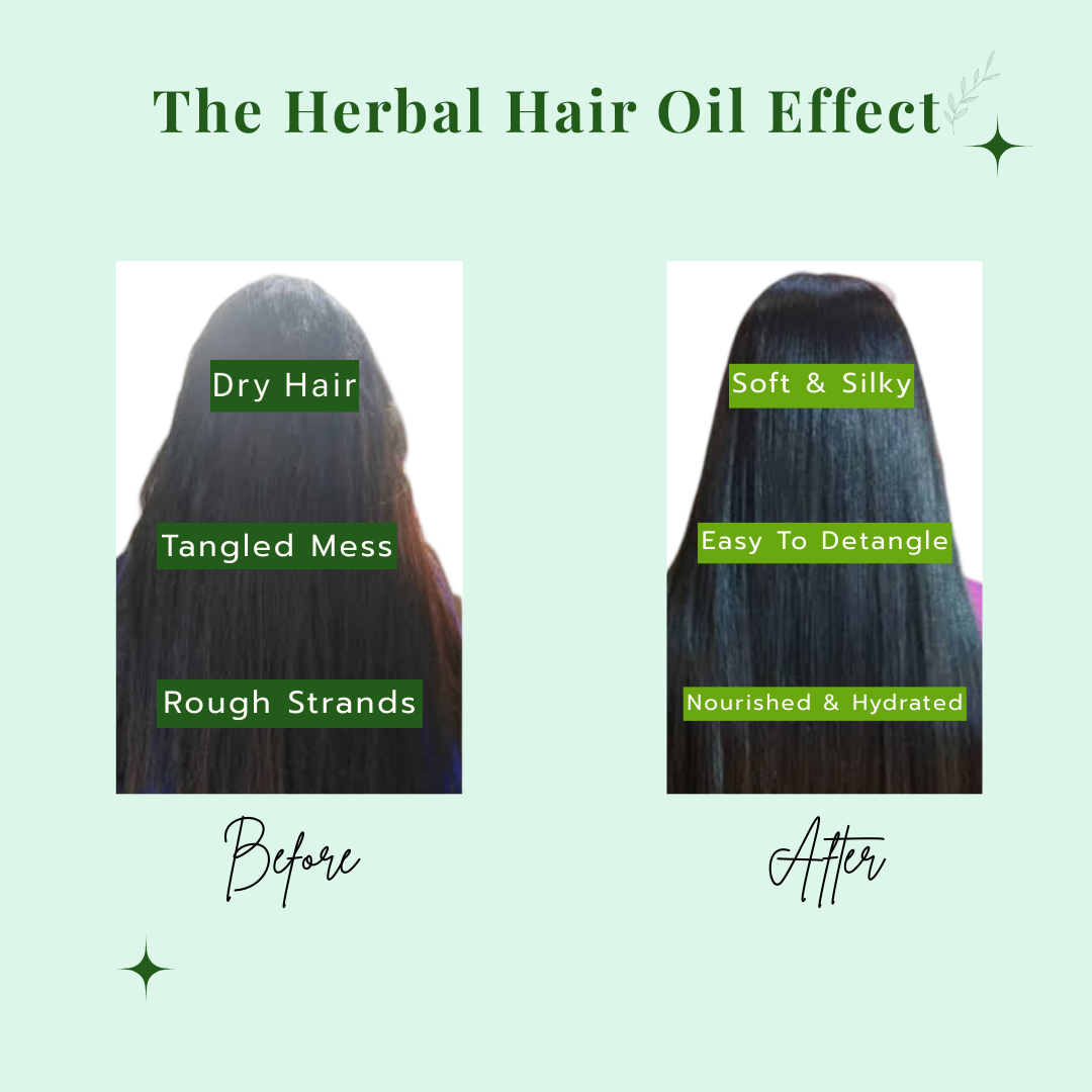 Tiny Veda Ancient Herbal Hair Oil with Cold Compressed Coconut Oil | Almond Oil |Sesame Oil & Castor Oil (100ml 11 Herbs)