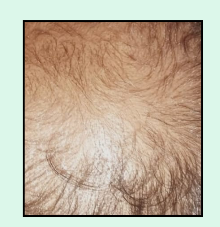 First Image